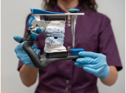 Screw-Retained Implant Crown: Benefits, Limitations and Case Planning