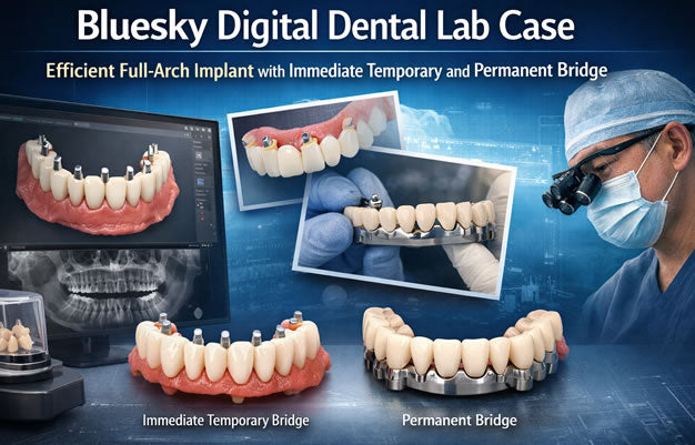 Bluesky Digital Dental Lab Case: Efficient Full-Arch Implant with Immediate Temporary and Permanent Bridge