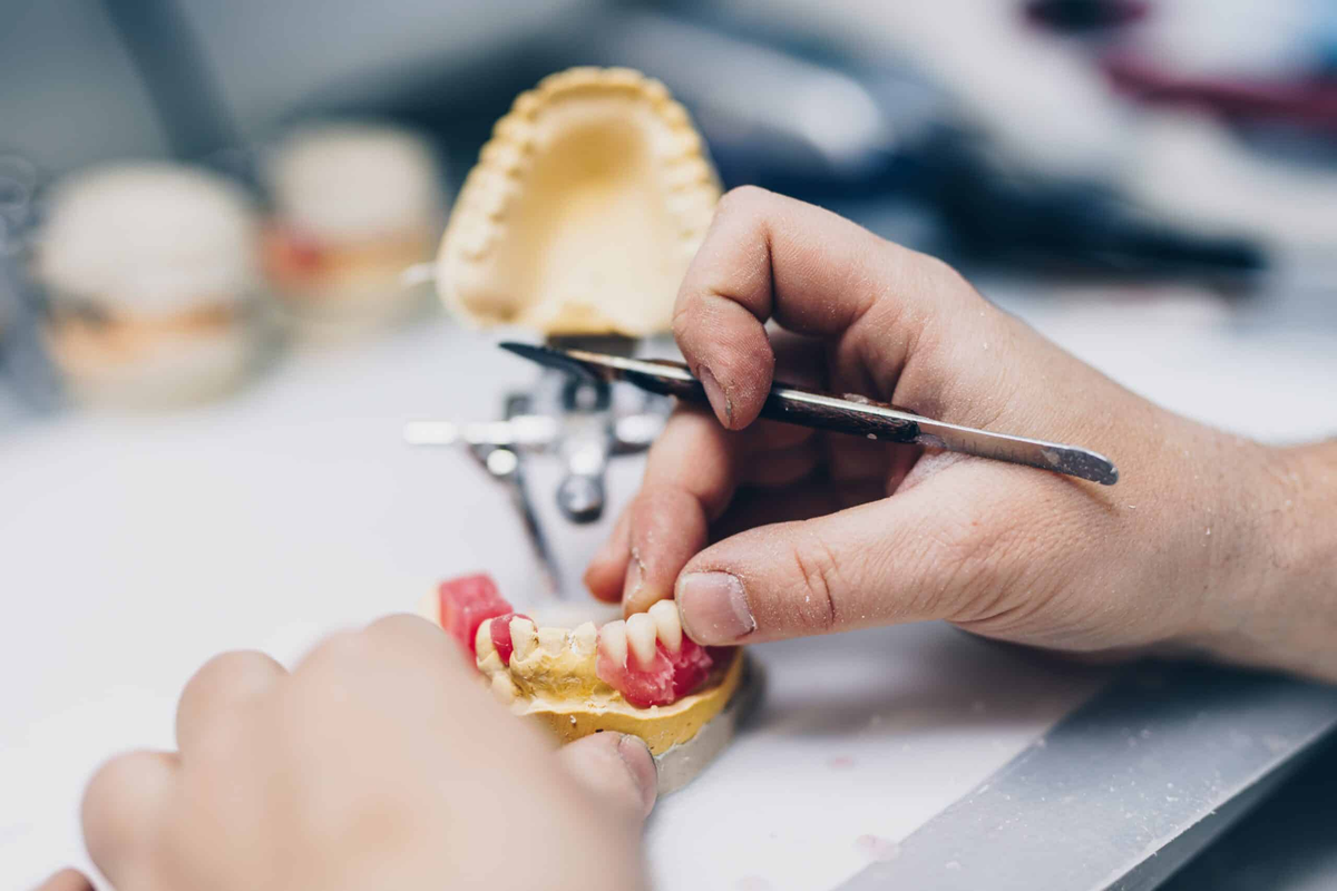 Dental Lab Turnaround Time: What Dentists Should Expect for Common Cases