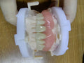 Acrylic Denture Resin Teeth Affordable Full Acrylic Denture