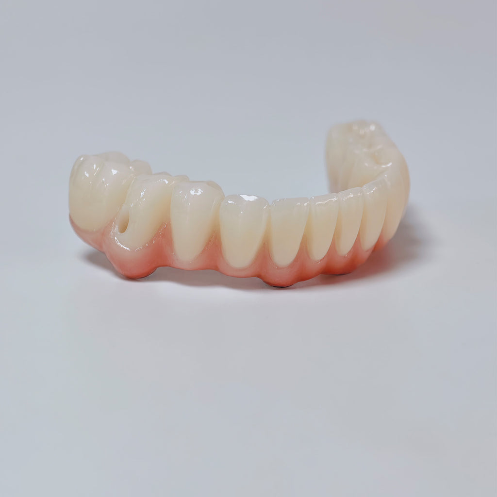 All On 4 Zirconia Bridge With Ti-Base Screw Retained