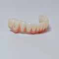All On 4 Zirconia Bridge With Ti-Base Screw Retained