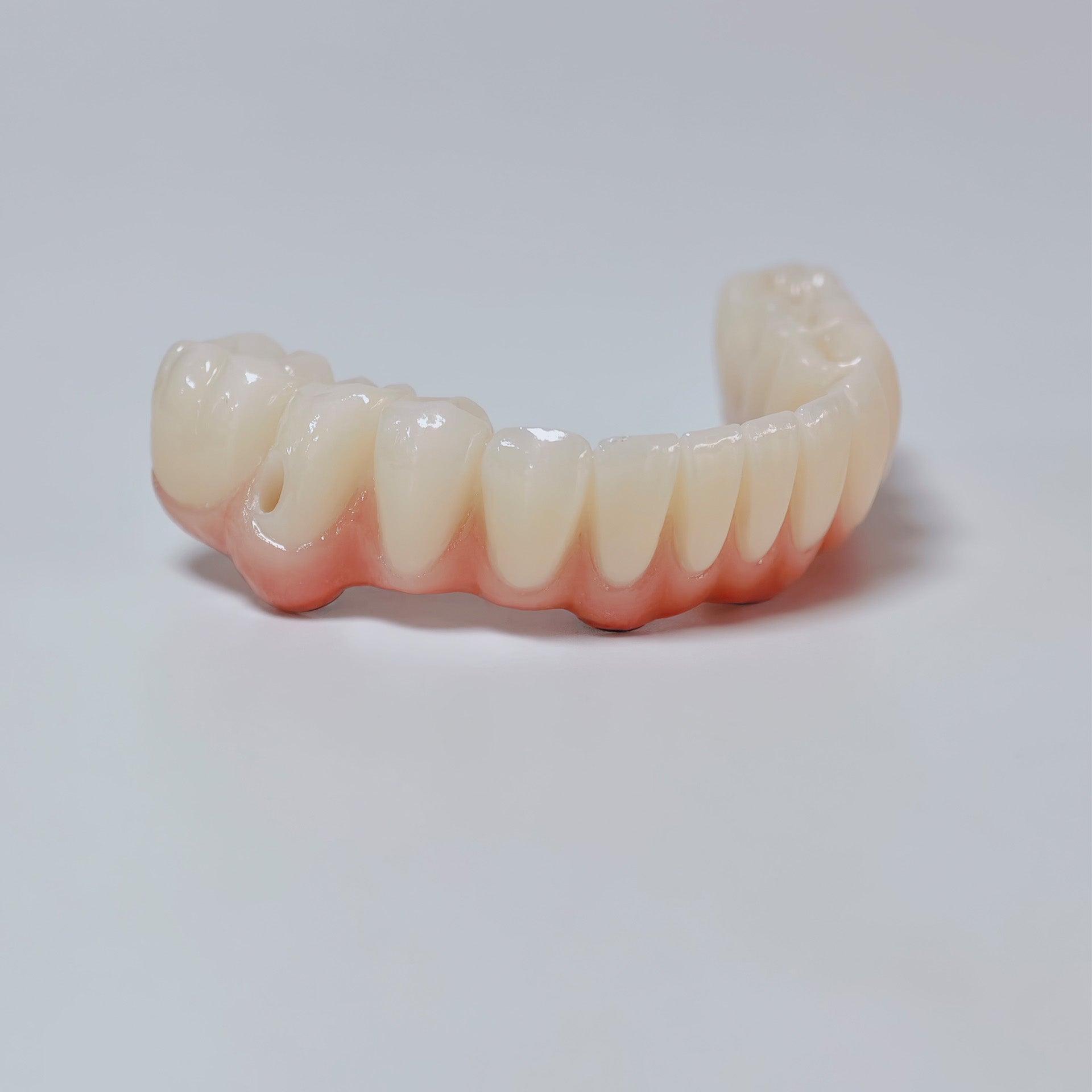All On 4 Zirconia Bridge With Ti-Base Screw Retained