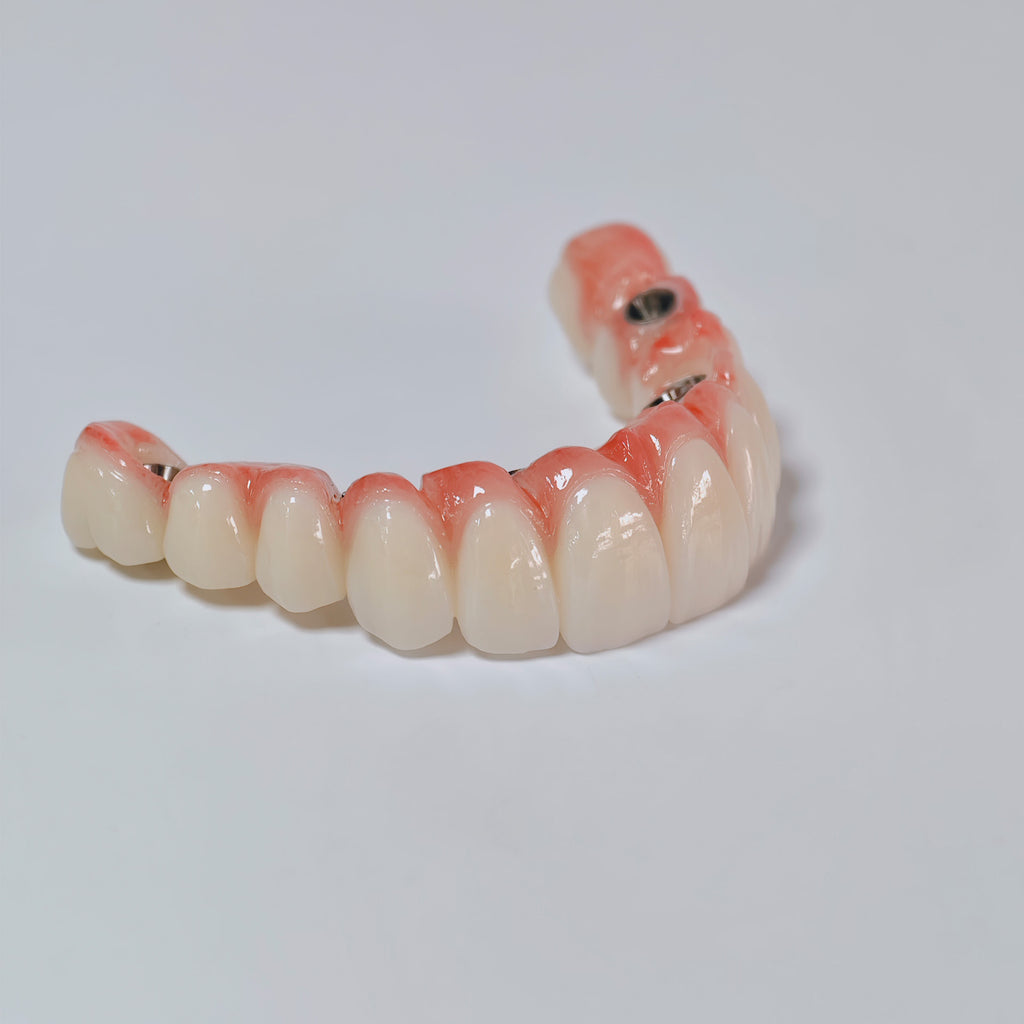 All On 6 Zirconia Bridge With Ti-Base Screw Retained