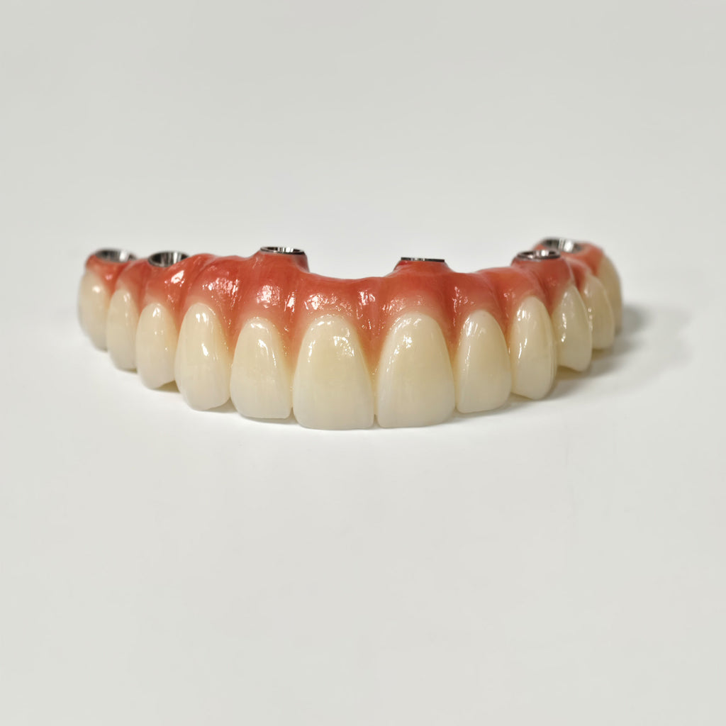 All On 6 Zirconia Bridge With Ti-Base Screw Retained