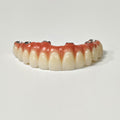 All On 6 Zirconia Bridge With Ti-Base Screw Retained