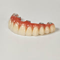 All On 6 Zirconia Bridge With Ti-Base Screw Retained