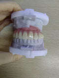 An Acrylic Denture With A Titanium Bar (Ti-Bar) Cost-Effective Full Arch Restoration Screw Retained