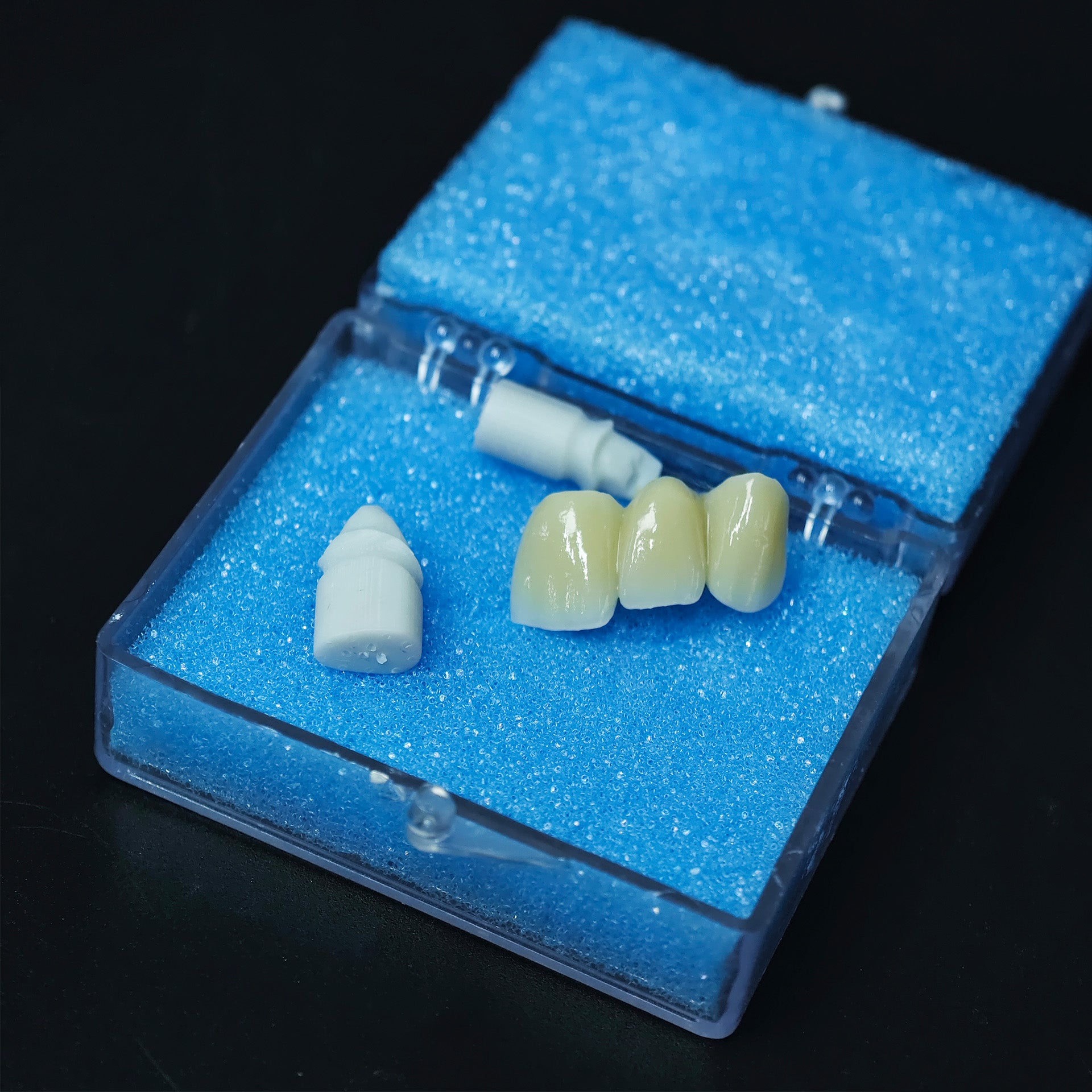 Beautiful Zirconia Bridge
