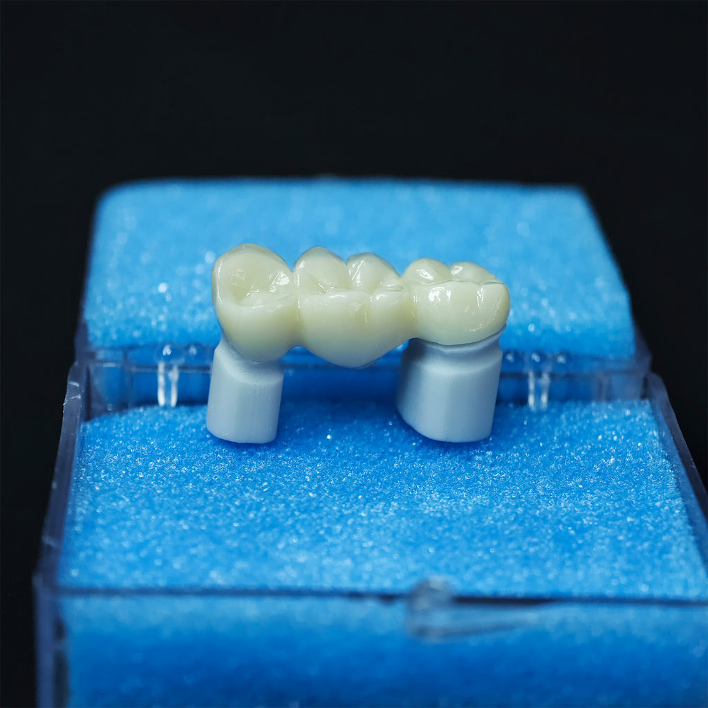 Beautiful Zirconia Bridge