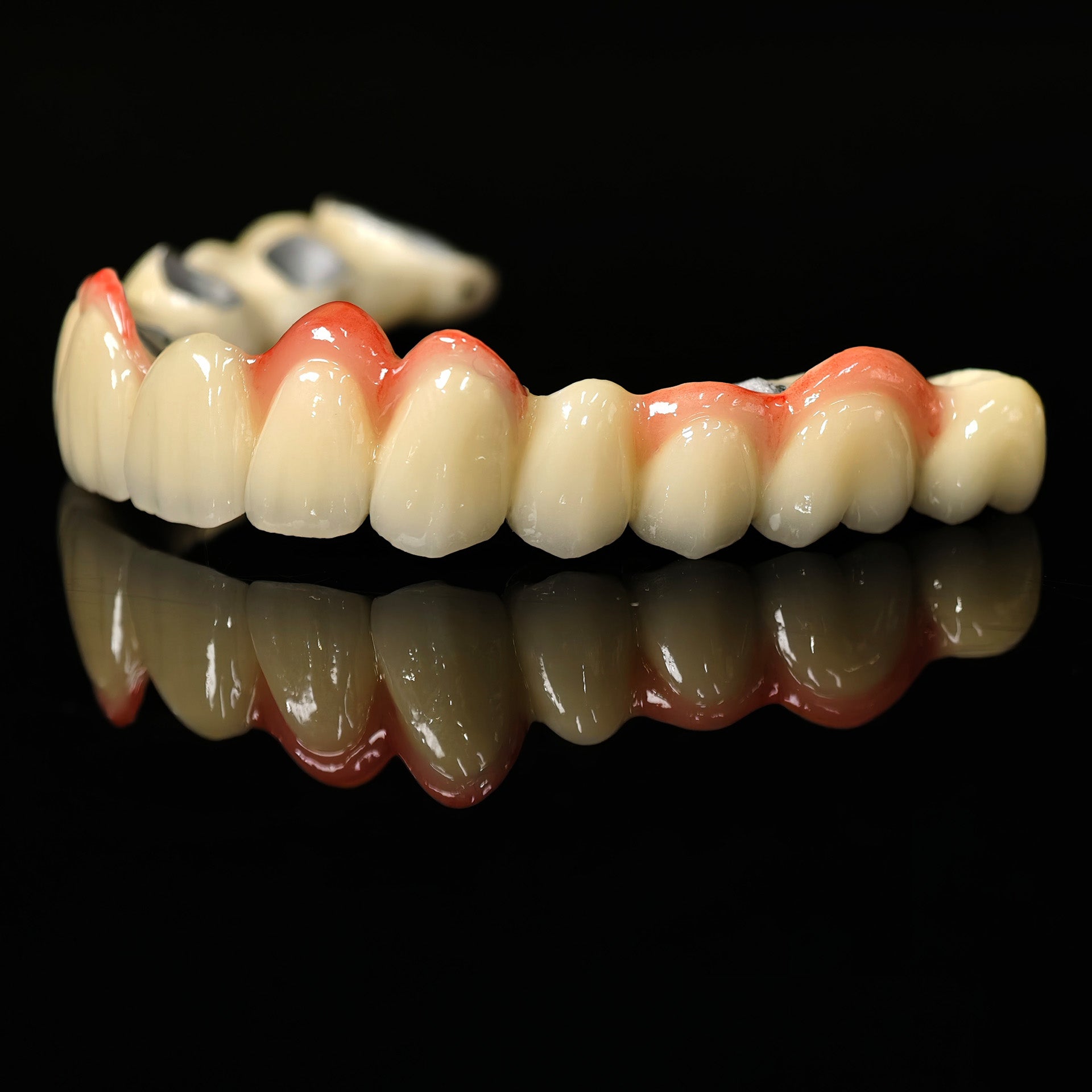 Co - Cr PFM Dental Bridge