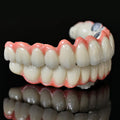Co - Cr PFM Dental Bridge