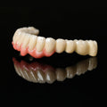 Co - Cr PFM Dental Bridge