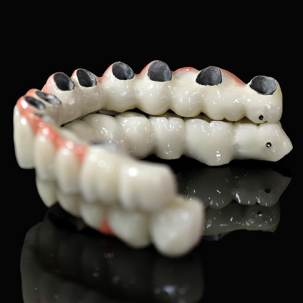 Co - Cr PFM Dental Bridge