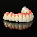Co - Cr PFM Dental Bridge