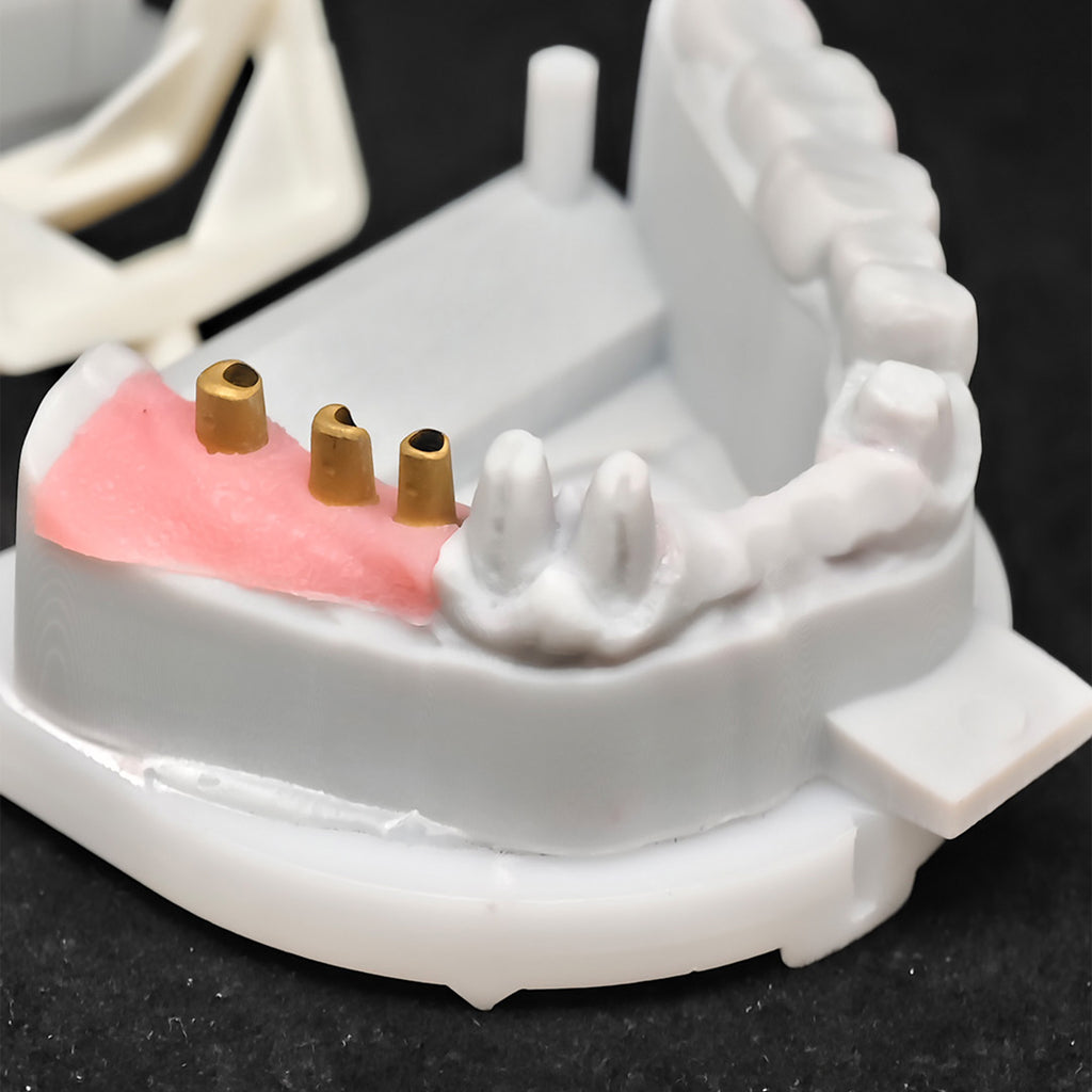 Co - Cr PFM Dental Bridge