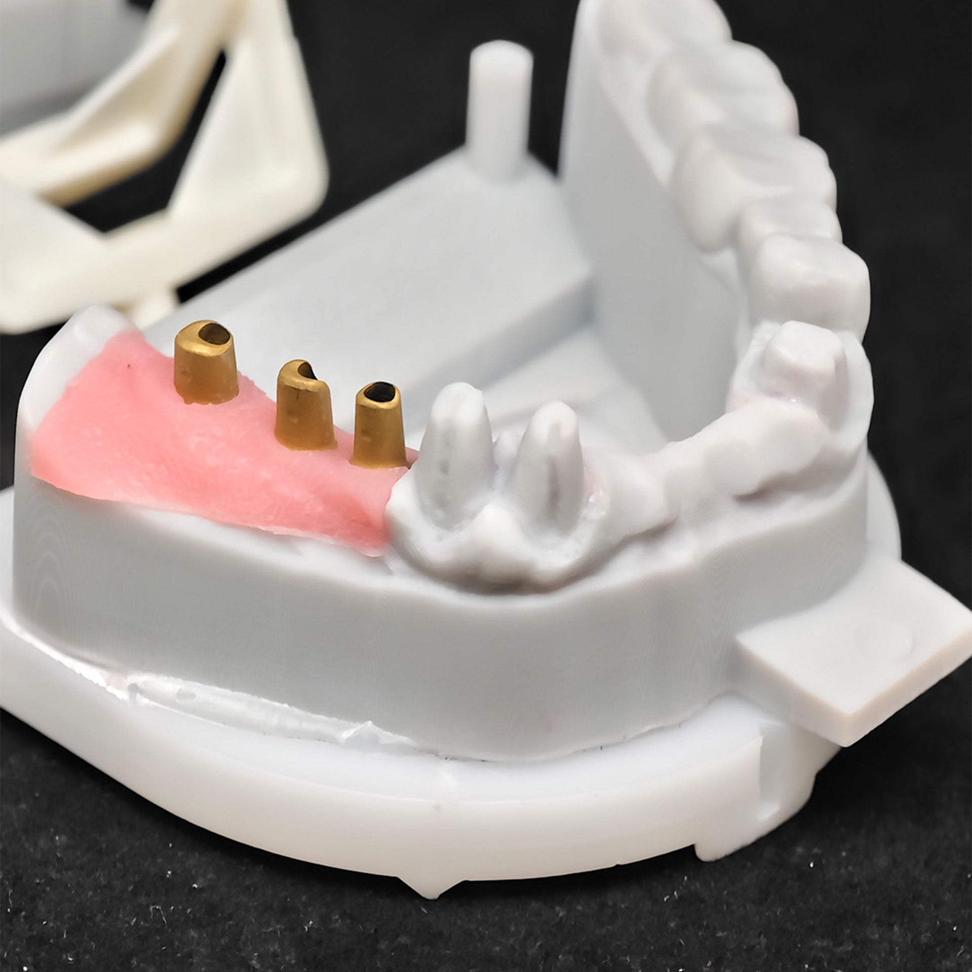 Co - Cr PFM Dental Bridge