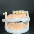 Co - Cr PFM Dental Bridge