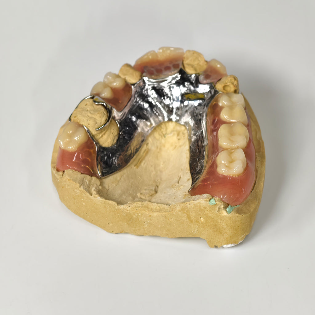 Cobalt Chrome Framework Denture Metal Framework With Acrylic Denture