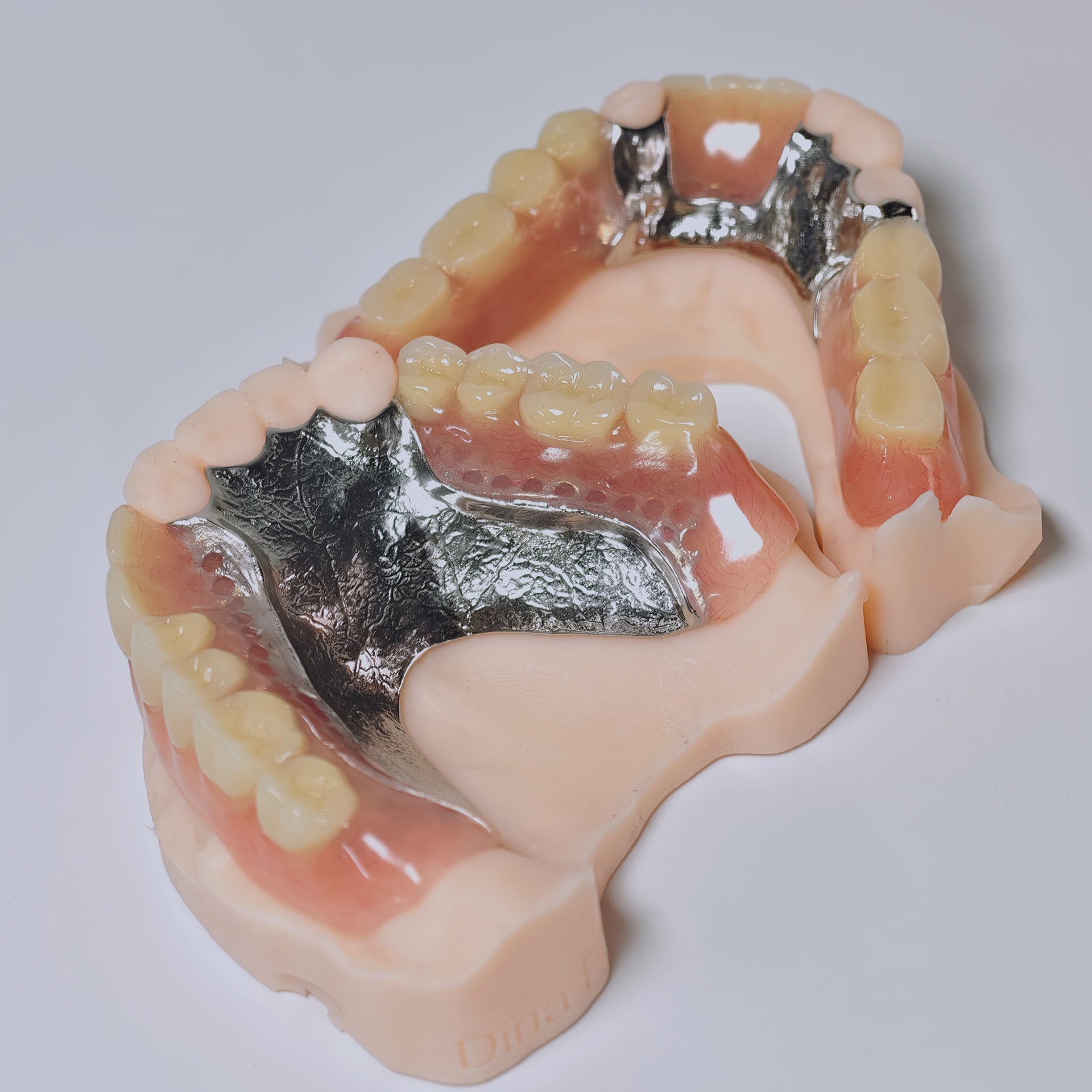 Cobalt Chrome Framework Denture Metal Framework With Acrylic Denture
