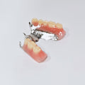 Cobalt Chrome Framework Denture Metal Framework With Acrylic Denture