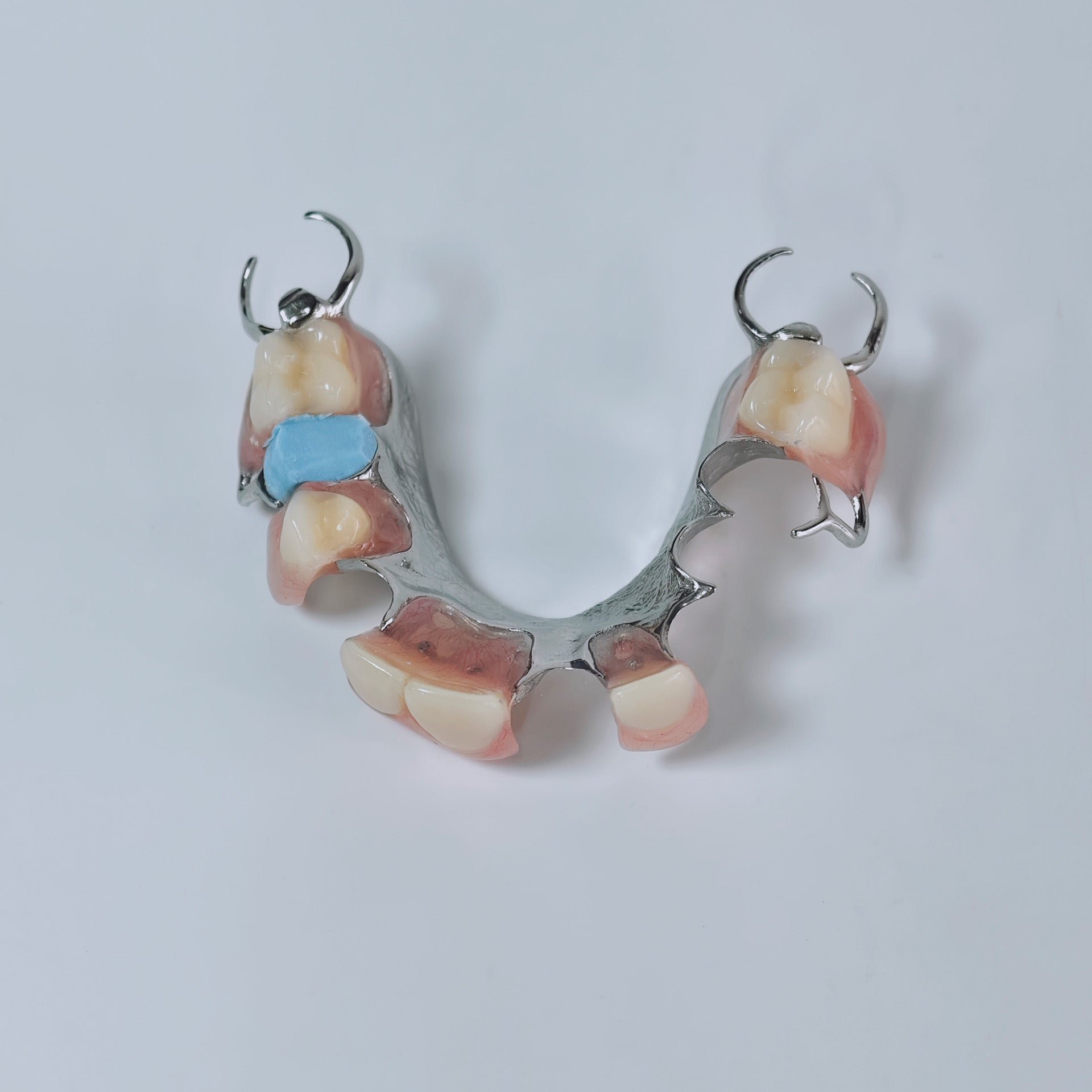 Cobalt Chrome Framework Denture Metal Framework With Acrylic Denture