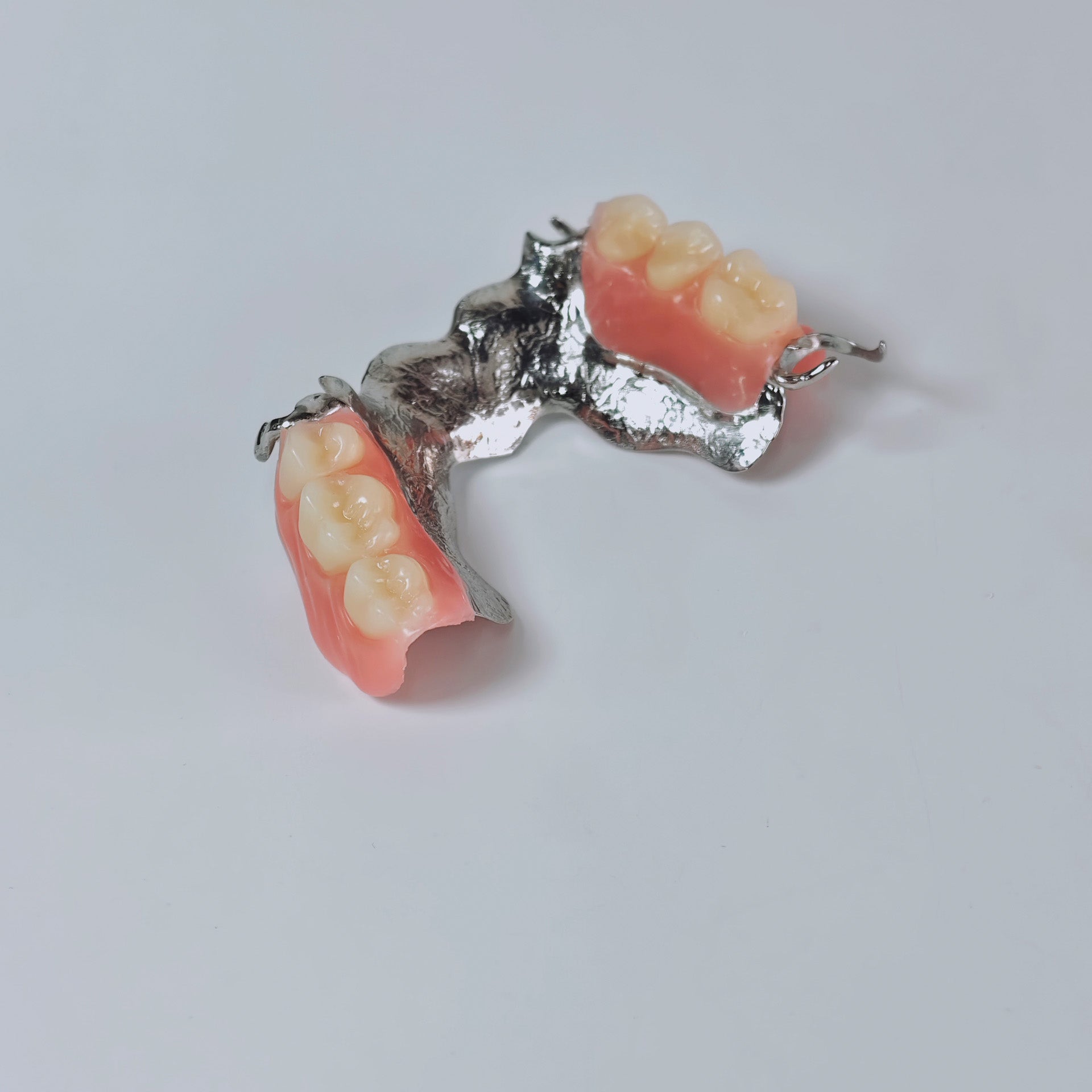 Cobalt Chrome Framework Denture Metal Framework With Acrylic Denture