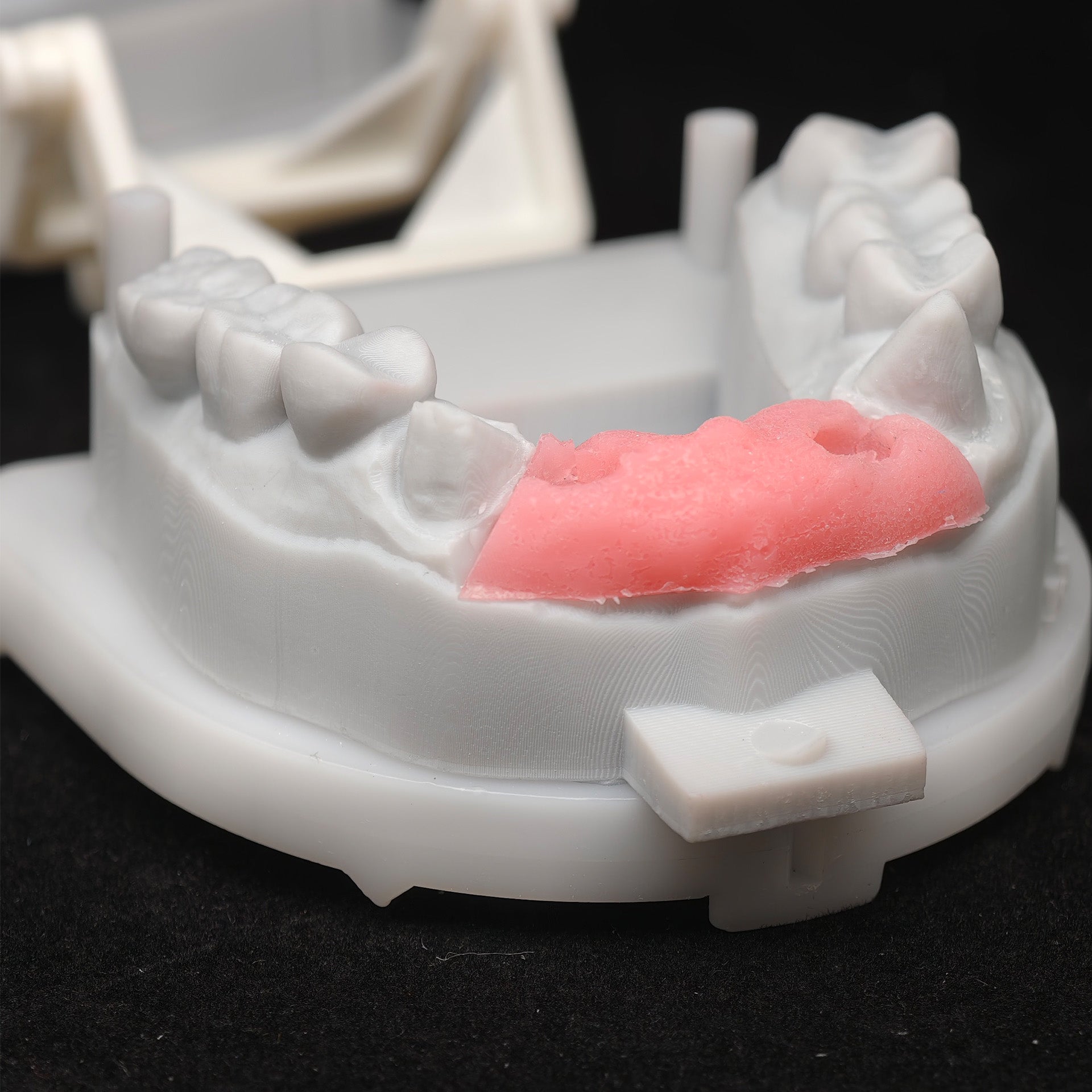 Custom Zirconia Implant Bridge