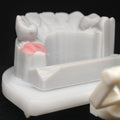 Custom Zirconia Implant Crown