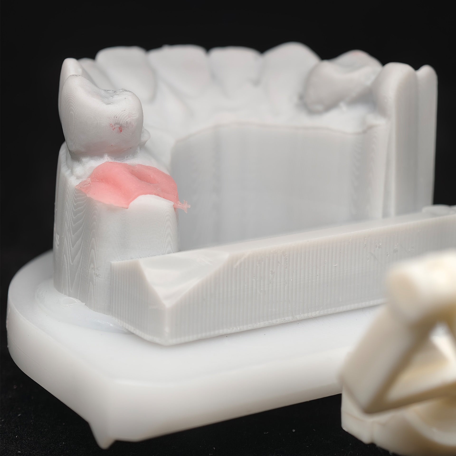 Custom Zirconia Implant Crown
