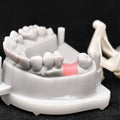 Custom Zirconia Implant Crown