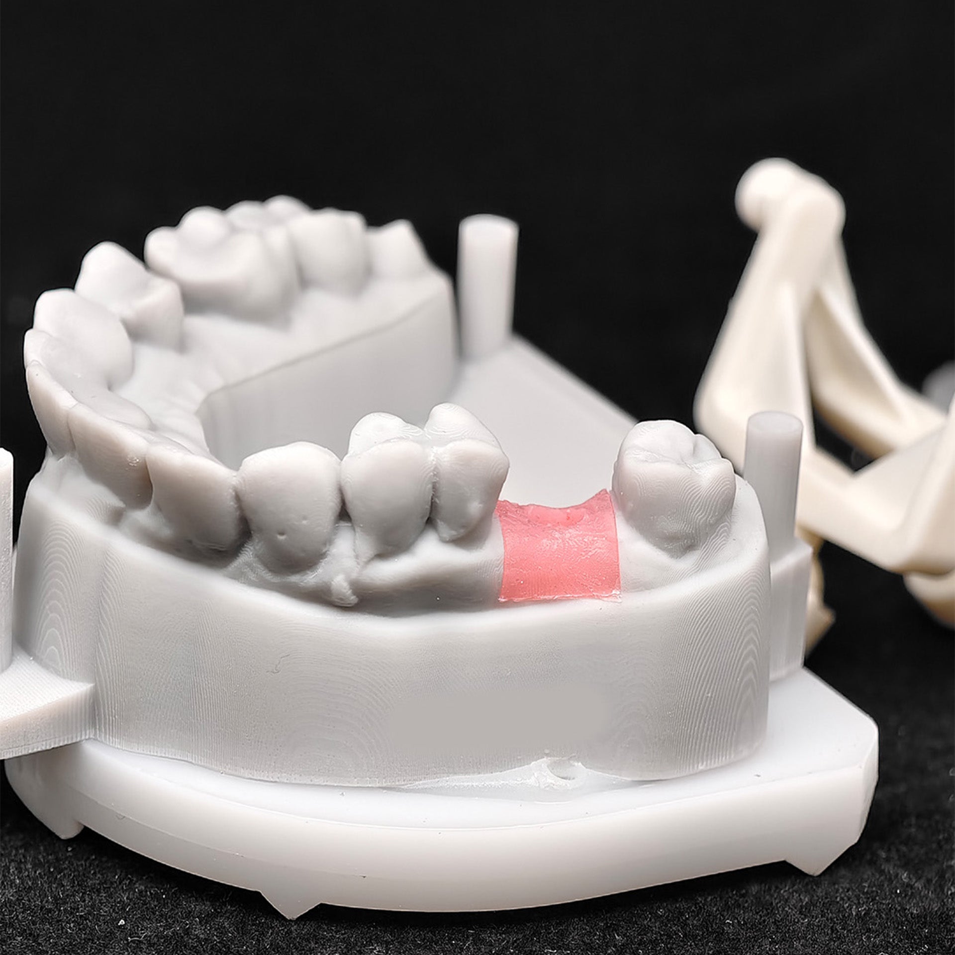 Custom Zirconia Implant Crown