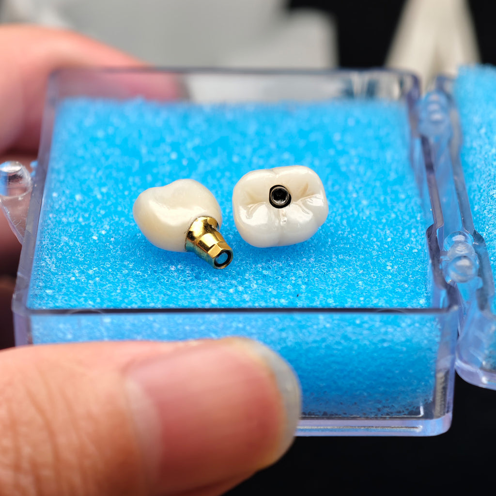 Custom Zirconia Implant Crowns