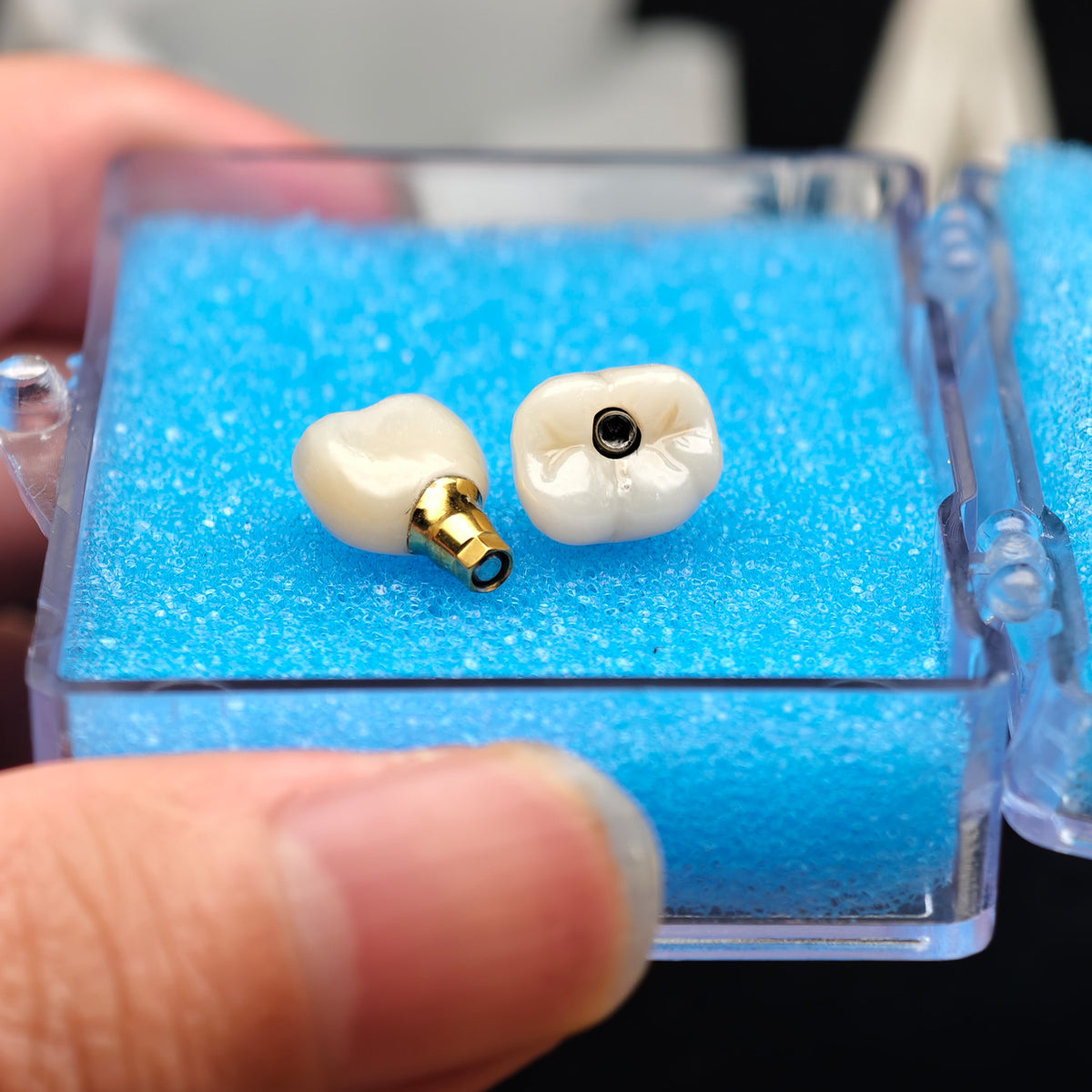 Custom Zirconia Implant Crowns