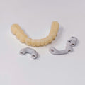 Custom Abutment And PMMA Bridge With Cement Retained And Implant Seating Guide