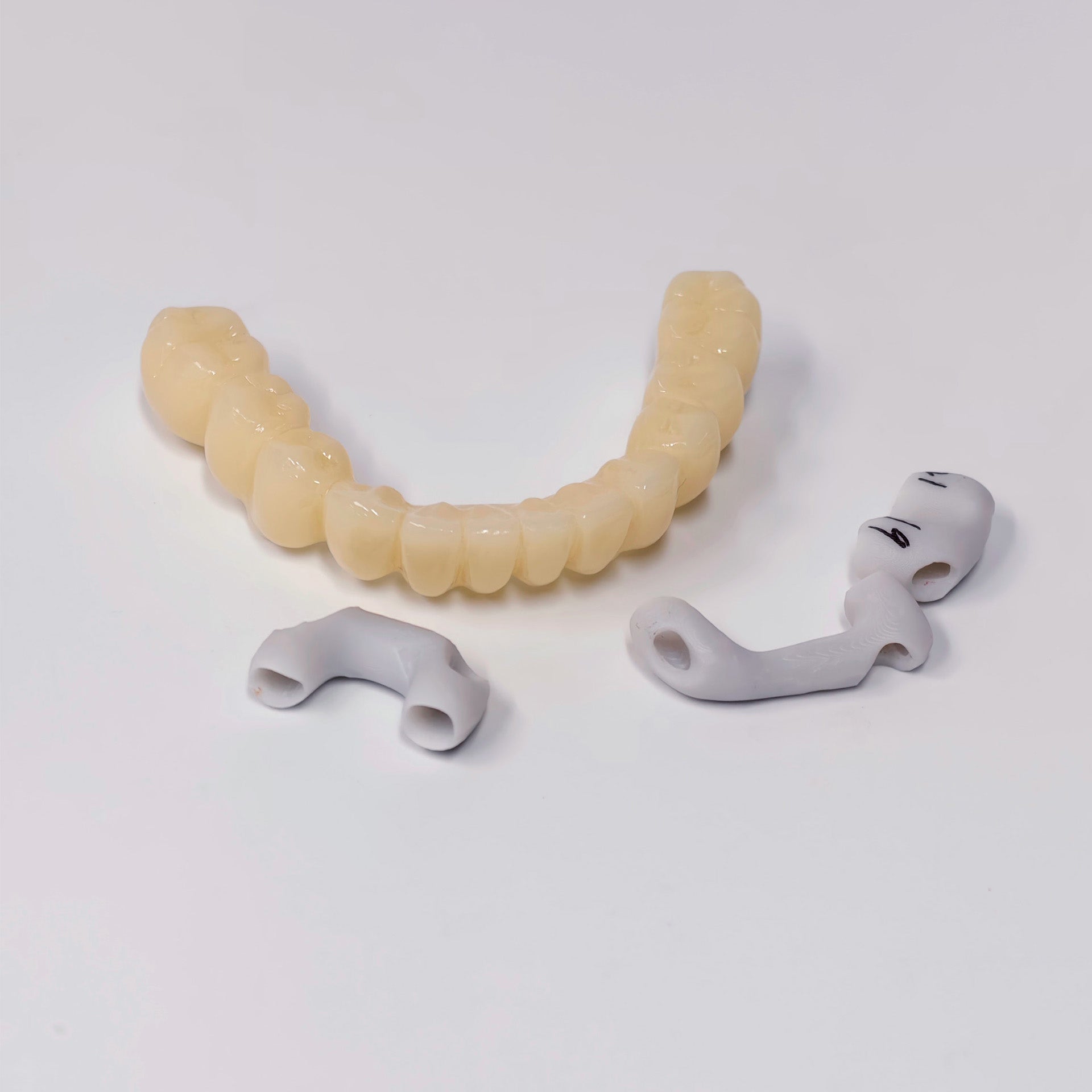 Custom Abutment And PMMA Bridge With Cement Retained And Implant Seating Guide