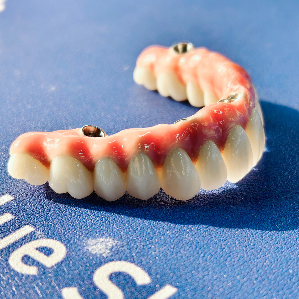 Enhanced Zirconia Crown Malo Bridge