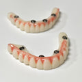 Full-Arch PMMA Bridge With Ti-Base Screw Retained