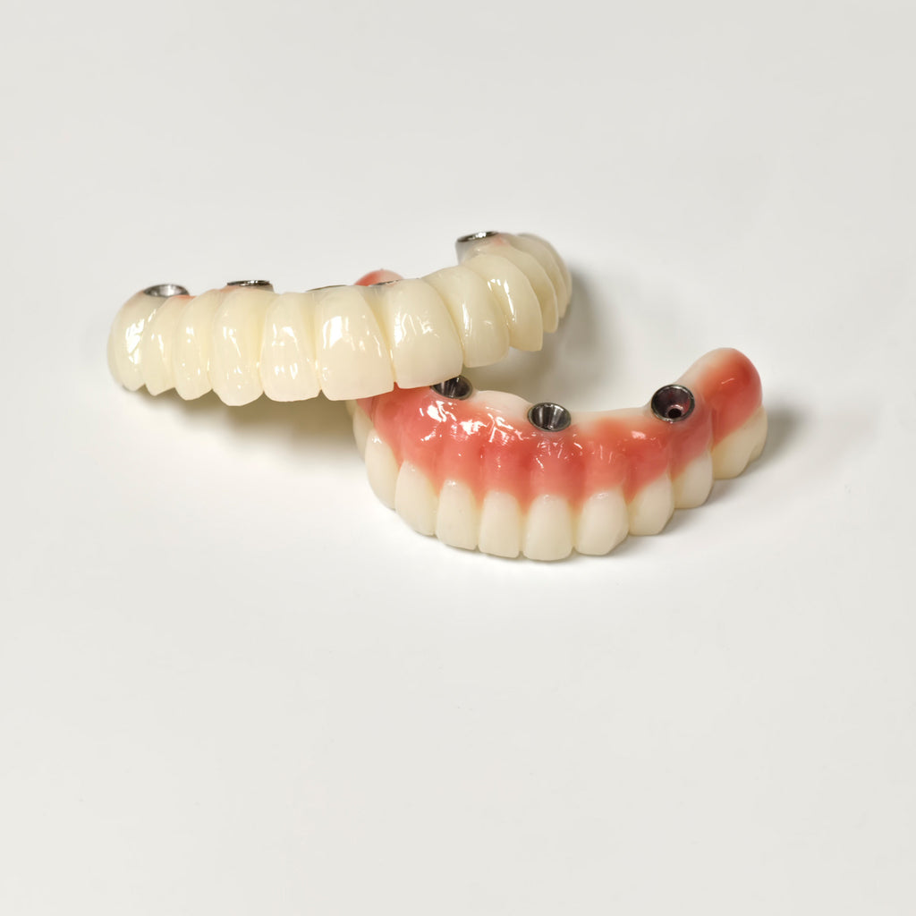 Full-Arch PMMA Bridge With Ti-Base Screw Retained