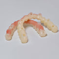 Full-Arch Zirconia Bridge And PMMA Bridge With Cement Retained