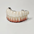 Full-Arch Zirconia Bridge With Ti-Base Abutment