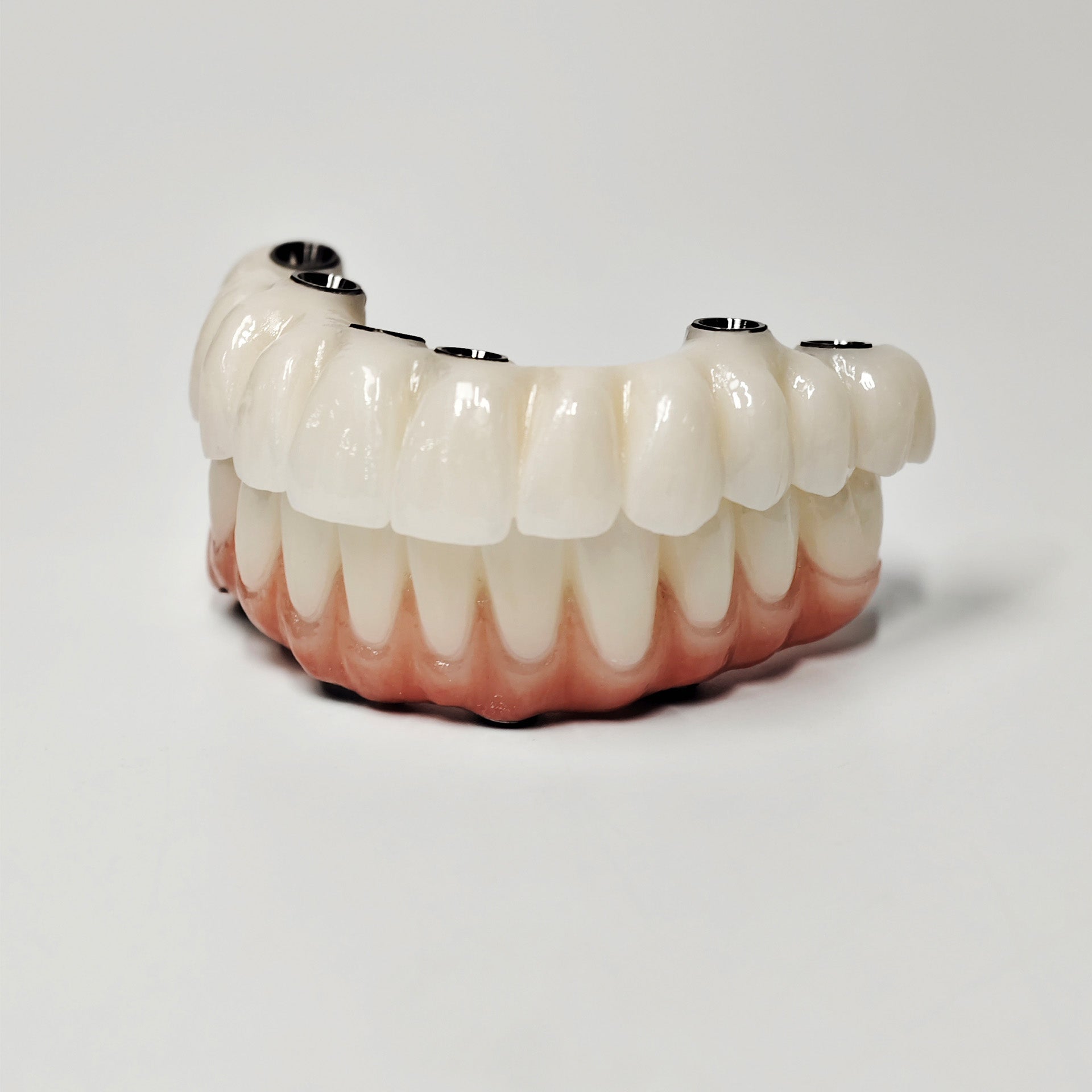 Full-Arch Zirconia Bridge With Ti-Base Abutment