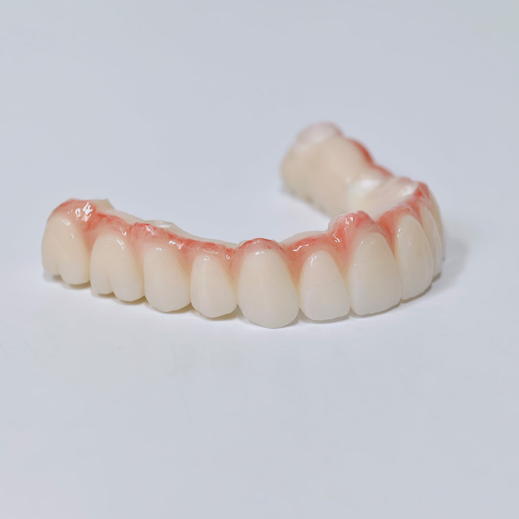 Half-Mouth Zirconia Bridge With Cement-Retained