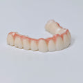Half-Mouth Zirconia Bridge With Cement-Retained