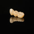 High - Strength Zirconia Bridge
