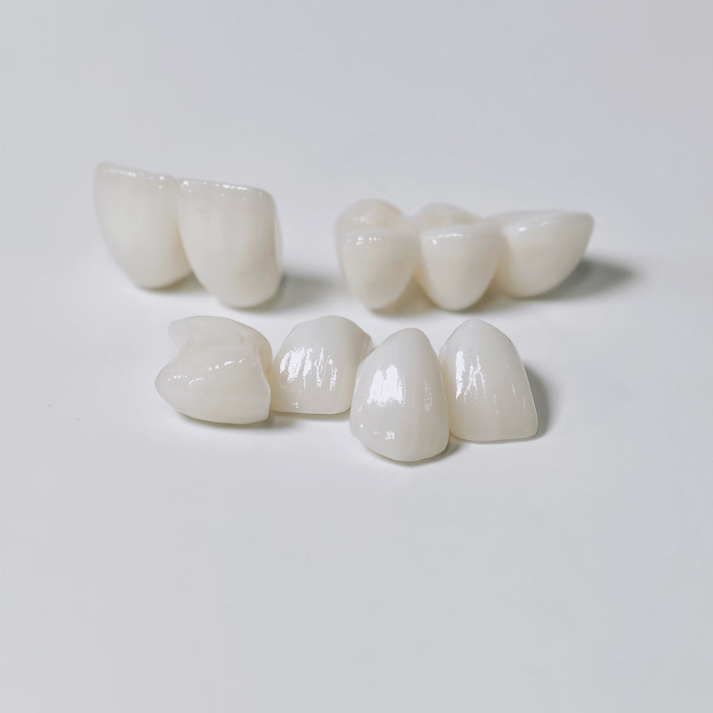 High - Strength Zirconia Bridge Aesthetic