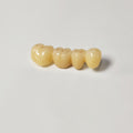 High - Strength Zirconia Bridge