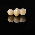 High - Strength Zirconia Bridge