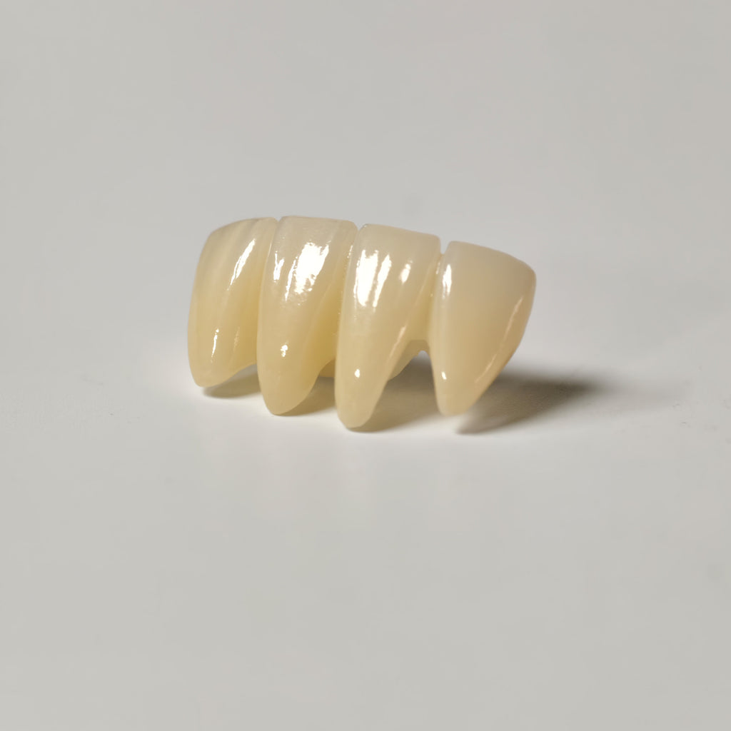 High - Strength Zirconia Bridge