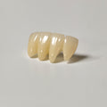 High - Strength Zirconia Bridge